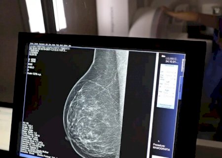 Outubro Rosa: como receber o auxílio-doença em tratamento de câncer