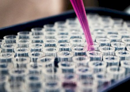 Pesquisas brasileiras avançam no diagnóstico de Alzheimer
