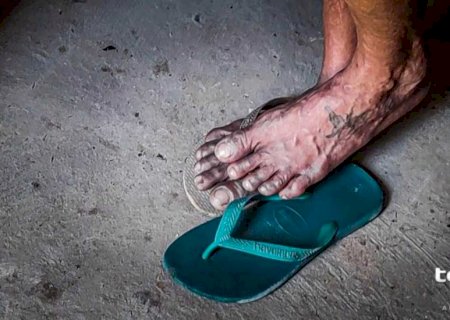 Idoso é resgatado de edícula com larvas pelo corpo em Selvíria