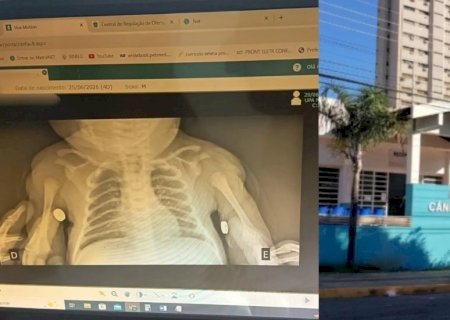 Bebê sai de maternidade com clavícula quebrada e família relata negligência