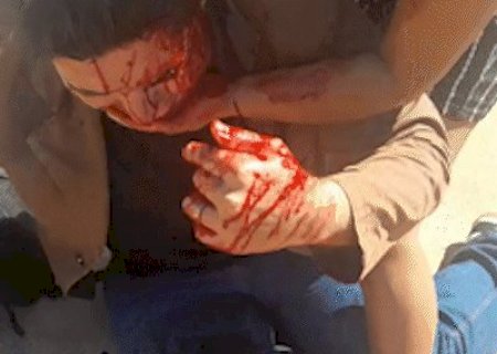 TRÊS LAGOAS: Jornalista aparece ensanguentado e diz que foi agredido por perseguição política